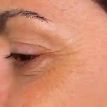 Close-up of wrinkles around closed eye.